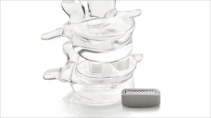 Silicon Nitride in Medical Devices