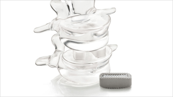 Silicon Nitride in Medical Devices